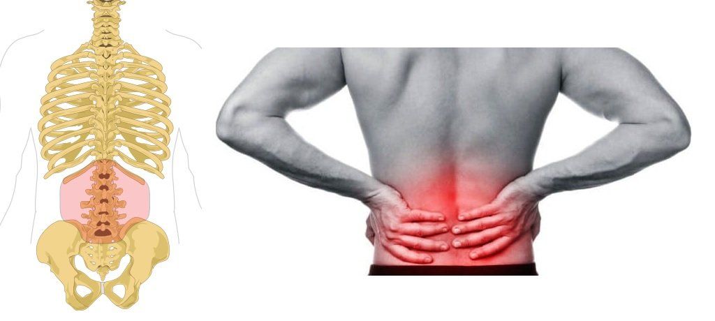 tratamiento osteopatico en dolor lumbar