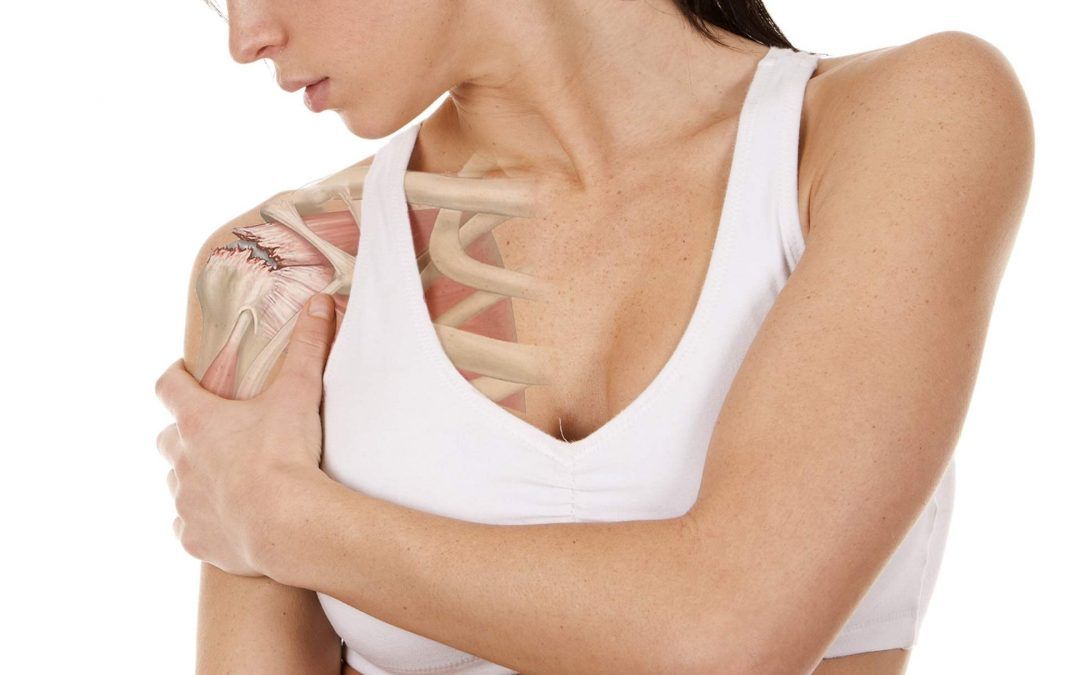 ¿Cómo ocurre el hombro congelado?