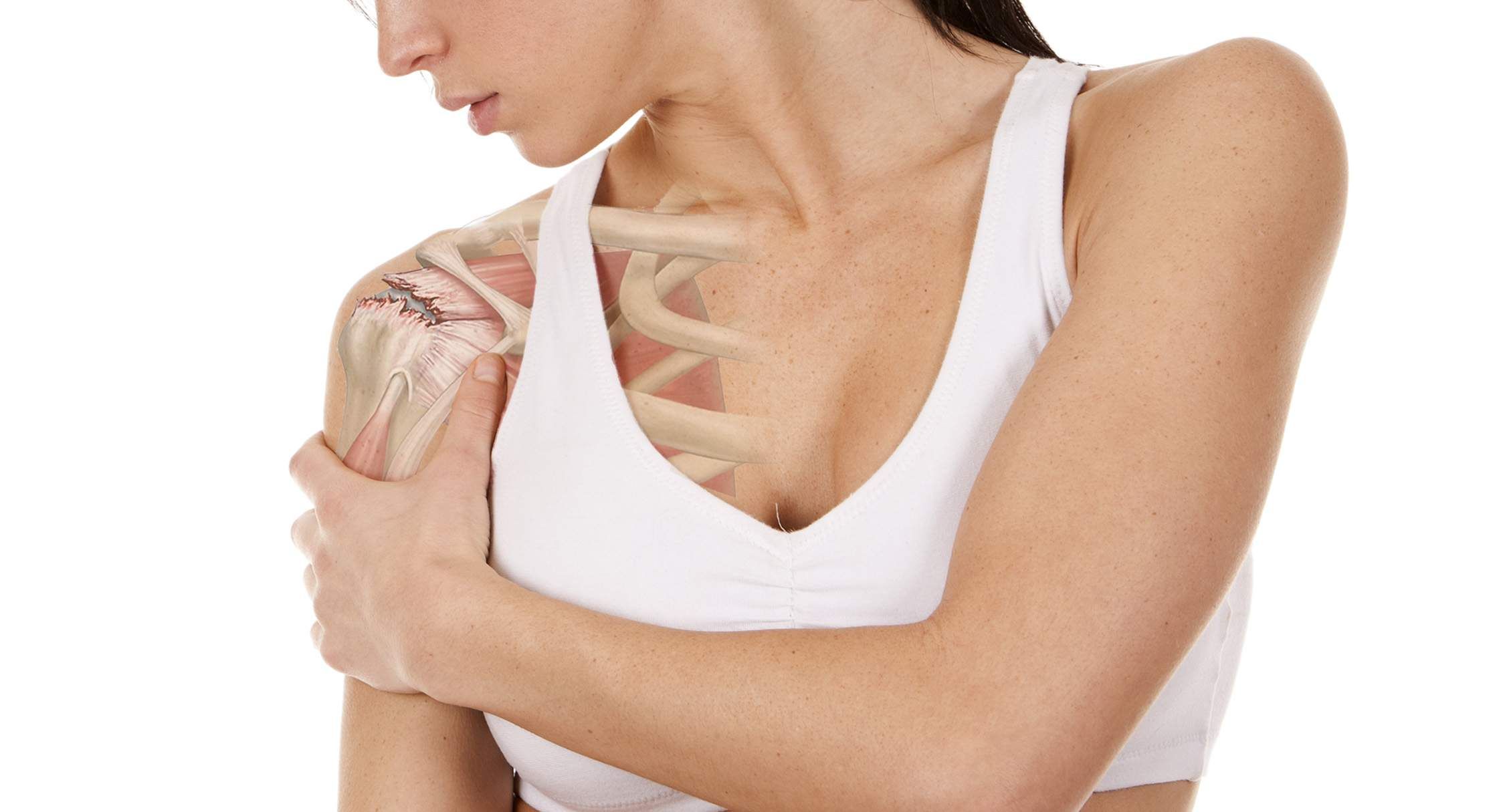 hombro congelado hombro congelado