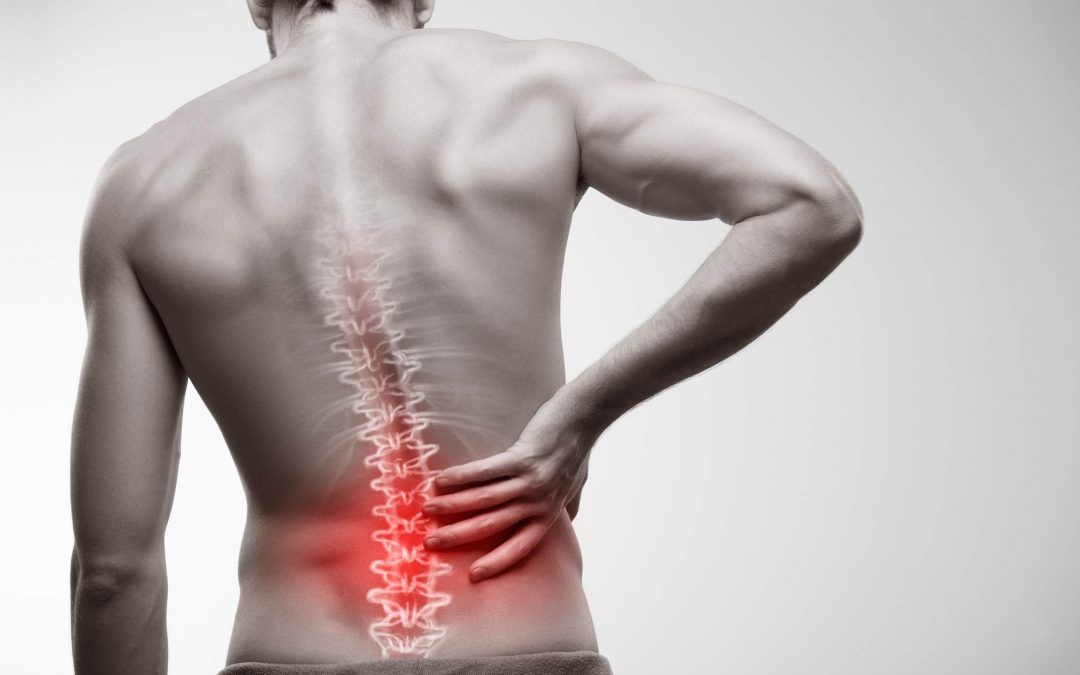 Hernia discal lumbar: lo que debe saber