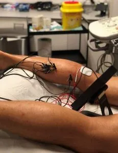 rotura gemelo belasategui 3