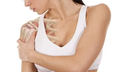 ¿Cómo ocurre el hombro congelado?