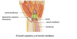 Tunel carpiano tratamiento