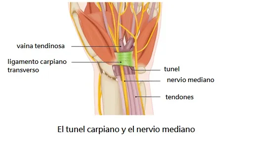 Tunel carpiano tratamiento