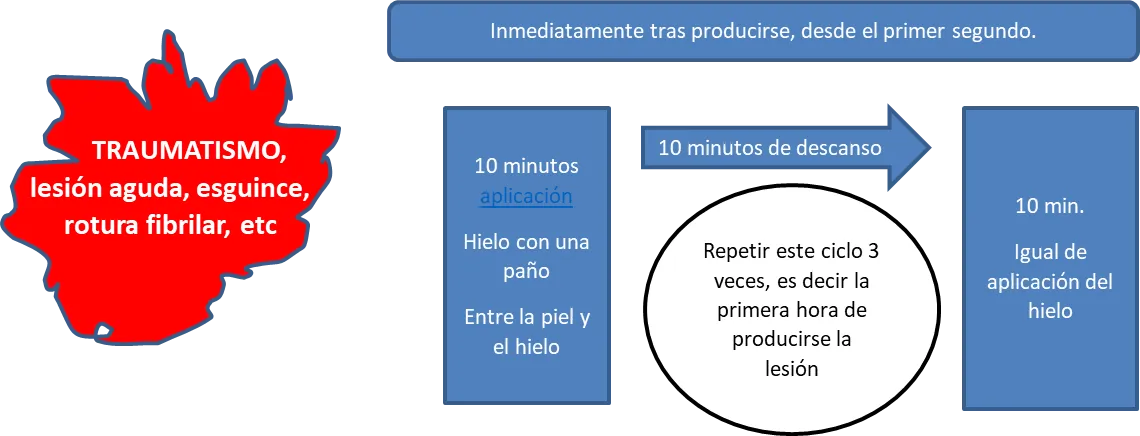 tratamiento contraste frio y calor