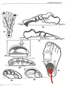esguince de tobillo clinica osteopatia javierdelanuez